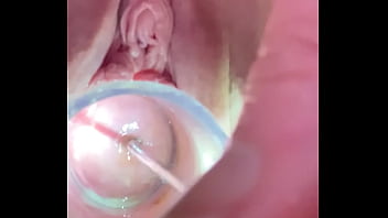 deep in cervix xxx