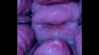 cervix porn